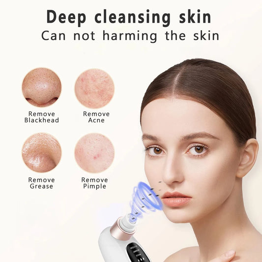 Vacuum Blackhead Remover Pore Face Cleaner Electric Pimple Acne Black Head Removal USB Rechargeable Water Cycle Black Dot Remove
