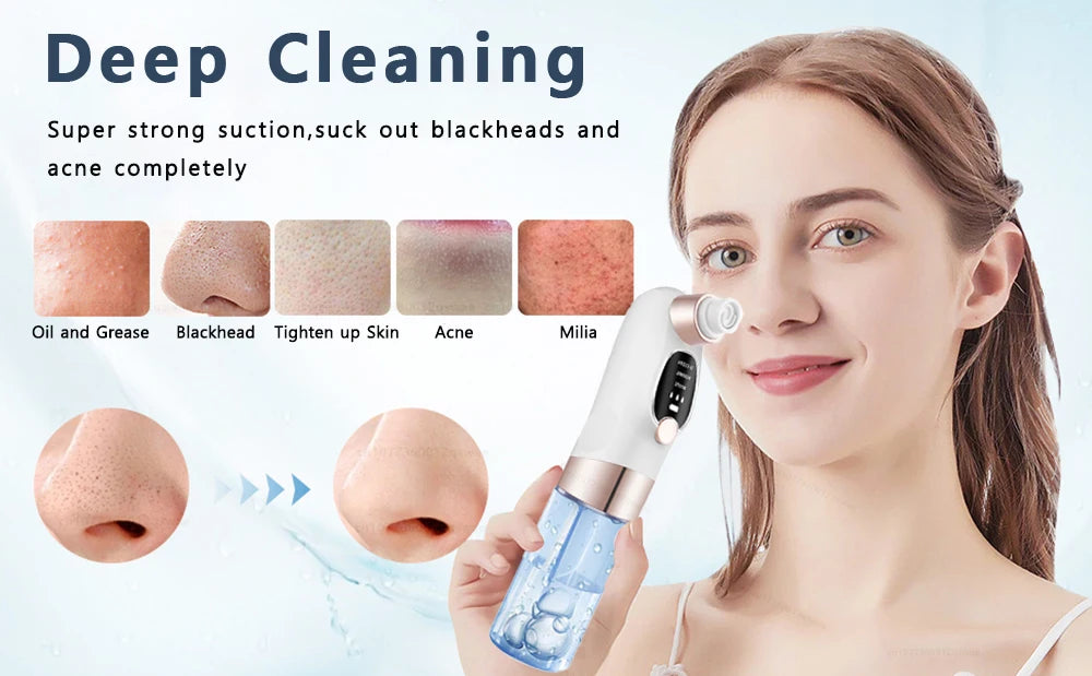 Vacuum Blackhead Remover Pore Face Cleaner Electric Pimple Acne Black Head Removal USB Rechargeable Water Cycle Black Dot Remove