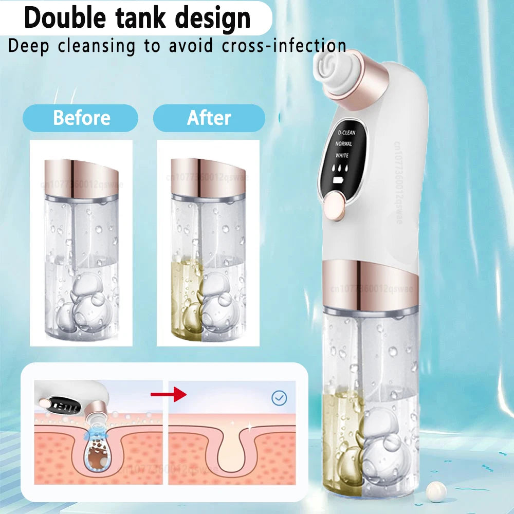 Vacuum Blackhead Remover Pore Face Cleaner Electric Pimple Acne Black Head Removal USB Rechargeable Water Cycle Black Dot Remove