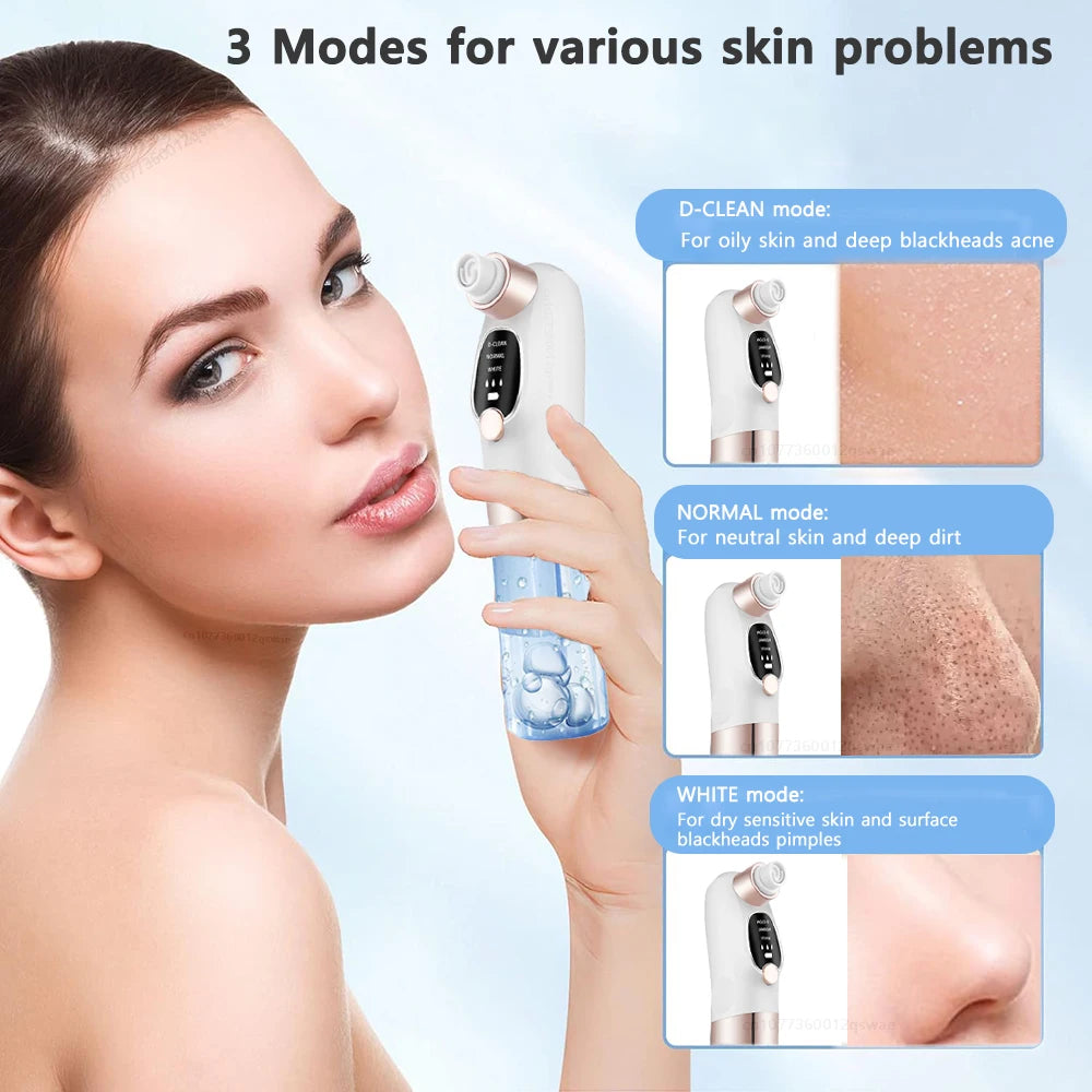 Vacuum Blackhead Remover Pore Face Cleaner Electric Pimple Acne Black Head Removal USB Rechargeable Water Cycle Black Dot Remove