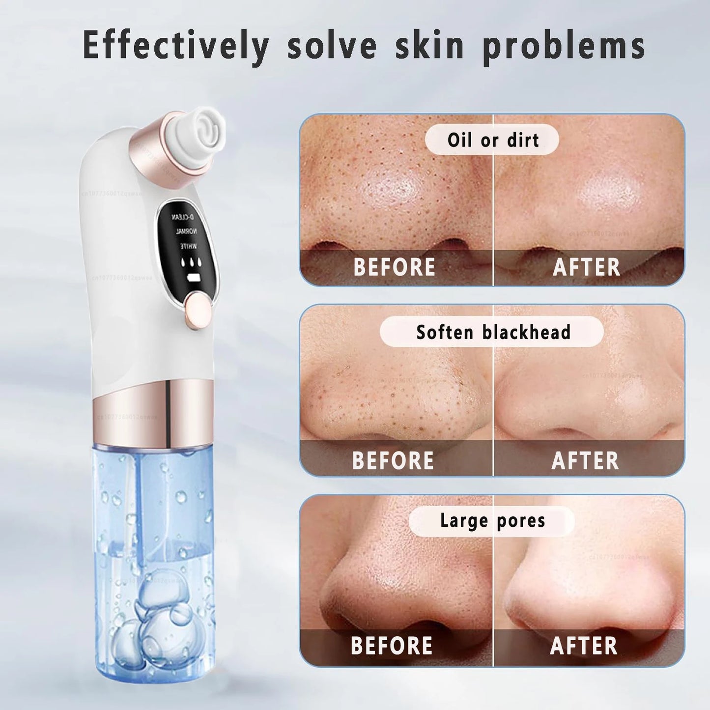 Vacuum Blackhead Remover Pore Face Cleaner Electric Pimple Acne Black Head Removal USB Rechargeable Water Cycle Black Dot Remove