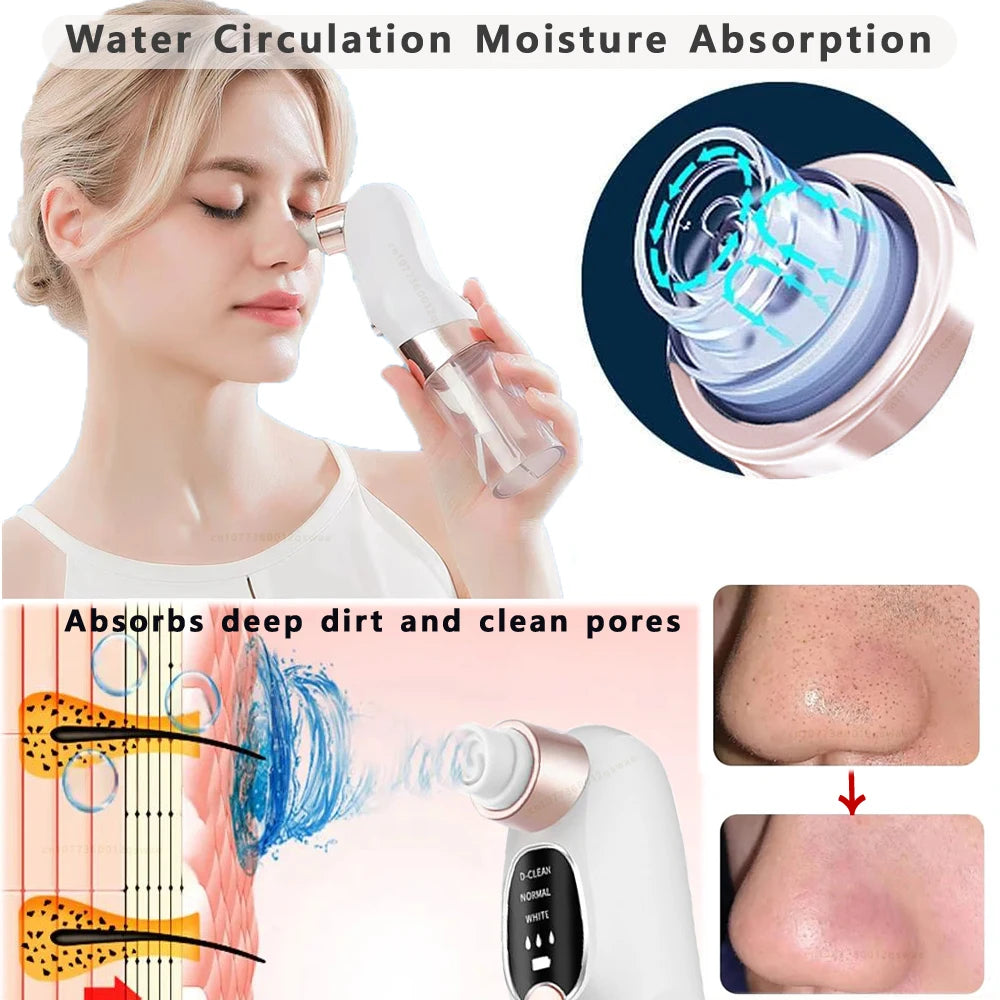 Vacuum Blackhead Remover Pore Face Cleaner Electric Pimple Acne Black Head Removal USB Rechargeable Water Cycle Black Dot Remove